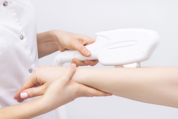 Dauerhafte Haarentfernung mit IPL